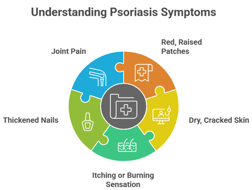 Psoriasis: Causes, symptoms & natural treatments - psoriasis management tips