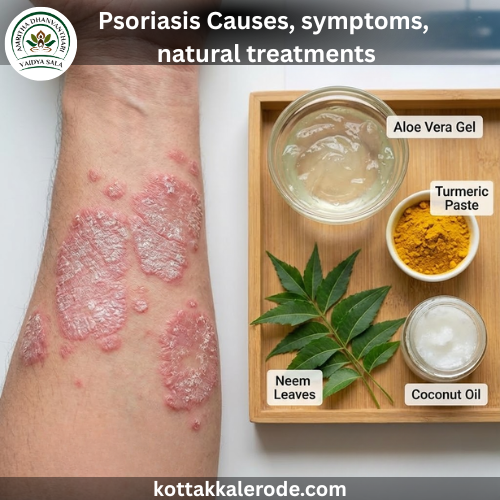 Explore psoriasis causes, symptoms and natural treatments. Find effective psoriasis management tips, diet guidance and lifestyle habits to reduce flare-ups.